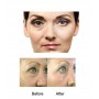 Derma váleček - tělo obličej oči - 3v1 zlatý - 4